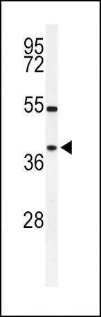 Anti-SIRT3 (C-term) Antibody