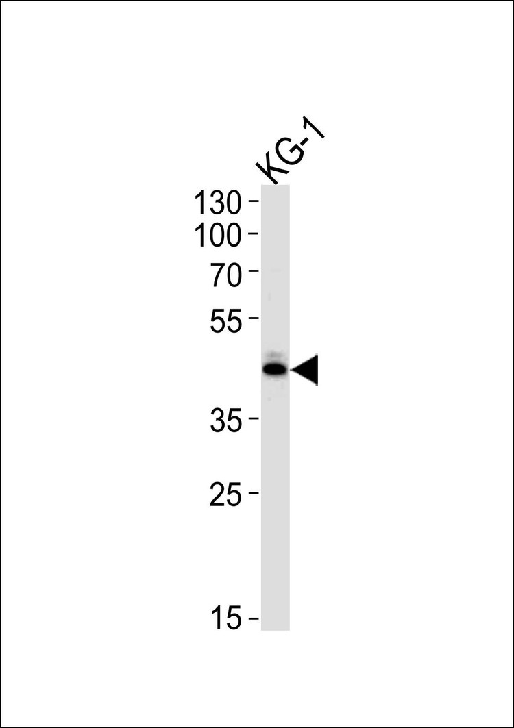 Anti-SIRT3 (C-term) Antibody