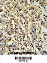 Anti-M Sirt3 (C-term) Antibody
