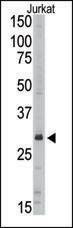 Anti-SIRT5 (C-term) Antibody