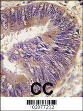 Anti-HSC70 Interacting Protein HIP (ST13) Antibody