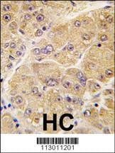 Anti-SOST (Center) Antibody