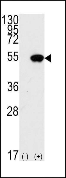 Anti-p53 (S15) Antibody