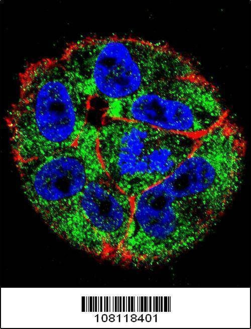 Anti-p53 (S15) Antibody