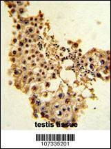 Anti-CCNE1 (C-term) Antibody