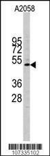 Anti-CCNE1 (C-term) Antibody