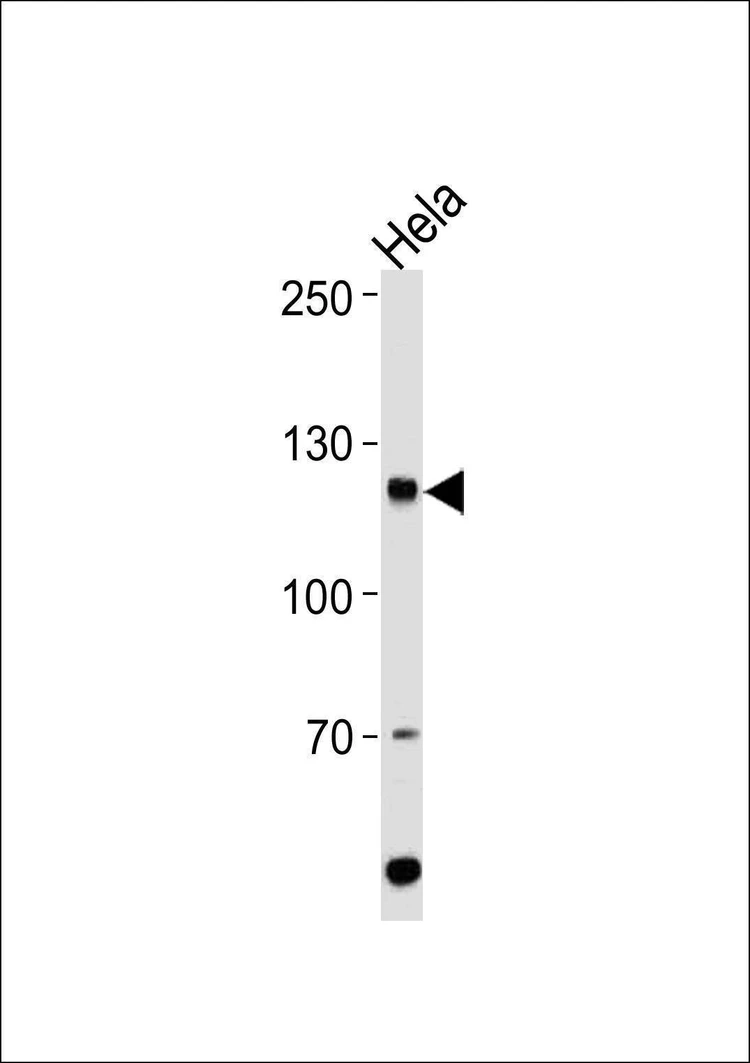 Anti-HIRA (Center) Antibody