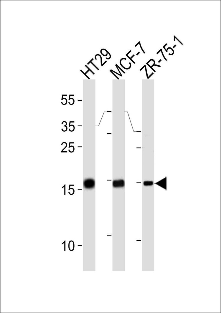 Anti-Anterior Gradient 2 (AGR2) (N-term) Antibody