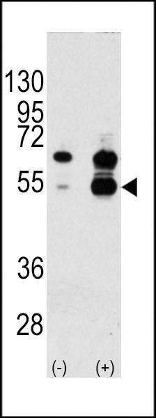 Anti-VEGF1 (N-term) Antibody