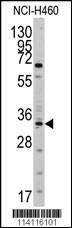 Anti-YB1 (YBX1) (N-term) Antibody