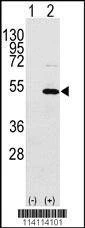 Anti-YBX1 (C-term) Antibody
