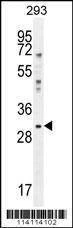 Anti-YBX1 (C-term) Antibody
