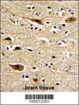 Anti-Mouse APP (N-term) Antibody