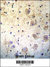 Anti-Kallikrein 6 (Center) Antibody