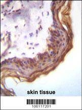 Anti-Kallikrein 7 (Center) Antibody