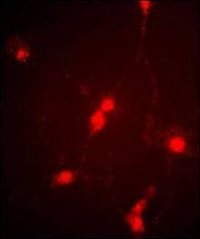 Anti-CLC4 (C-term) Antibody