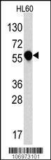 Anti-IL1R (C-term E487) Antibody