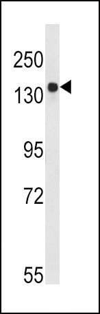 Anti-Tuberin (TSC2) (S1798) Antibody