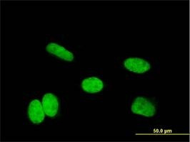 Anti-HOXA11 Antibody