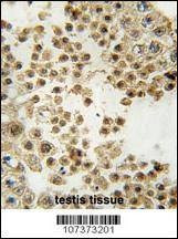 Anti-Parkin (C-term) Antibody