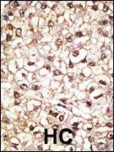 Anti-Parkin (C-term) Antibody