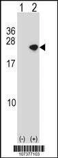Anti-SNCA (C-term) Antibody