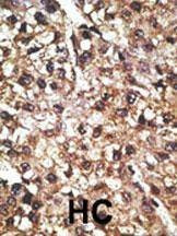 Anti-PINK1 (PARK6) (N-term T133) Antibody