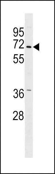 Anti-PINK1 (PARK6) (Center) Antibody