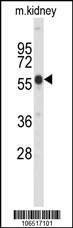 Anti-Park6 (PINK1) (C-term) Antibody