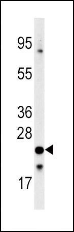 Anti-FXN (C-term) Antibody
