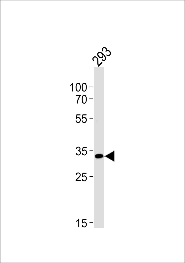 Anti-STUB1 (C-term) Antibody