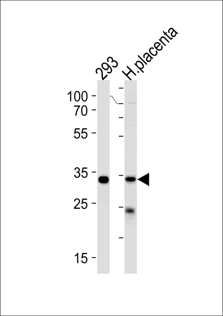 Anti-STUB1 (C-term) Antibody