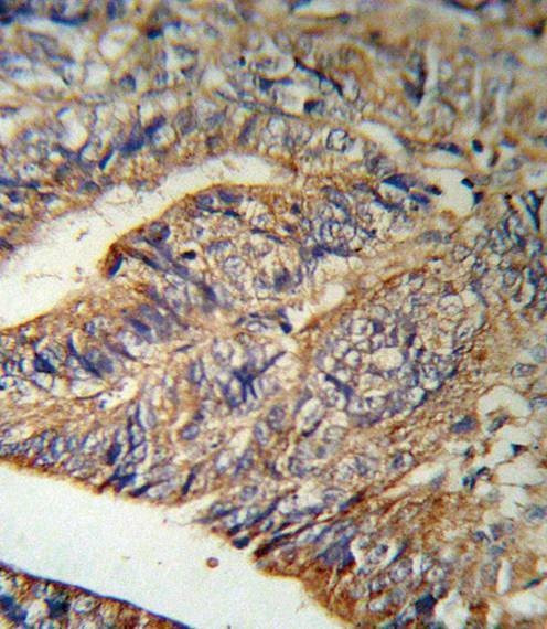 Anti-IL1RN (Center) Antibody