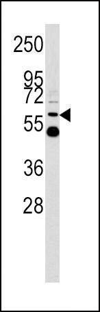 Anti-UDB17 (Center) Antibody