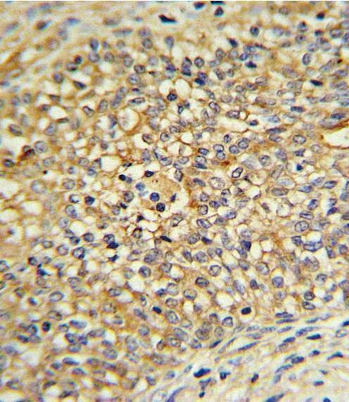 Anti-UDB17 (Center) Antibody