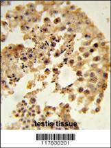 Anti-DPP8 (N-term) Antibody