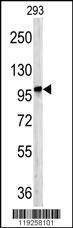 Anti-DPP8 (C-term) Antibody