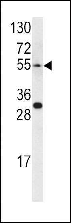 Anti-EDNRA (Center) Antibody