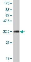 Anti-HOXB7 Antibody