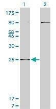 Anti-HOXB7 Antibody