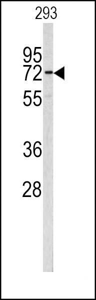 Anti-CEA (Center) Antibody