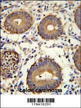 Anti-CEA (Center) Antibody