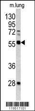 Anti-FLI1 (Center) Antibody