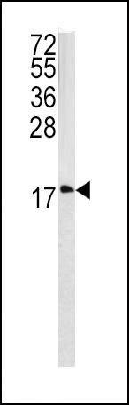 Anti-CAV3 (N-term) Antibody