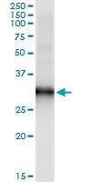 Anti-HOXB9 Antibody