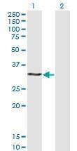 Anti-HOXB9 Antibody