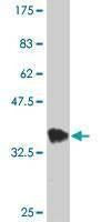 Anti-HOXB9 Antibody