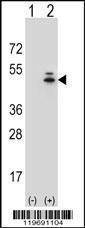 Anti-ACTG1 (Center) Antibody