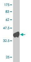 Anti-HOXC10 Antibody