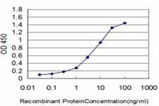 Anti-HOXC10 Antibody